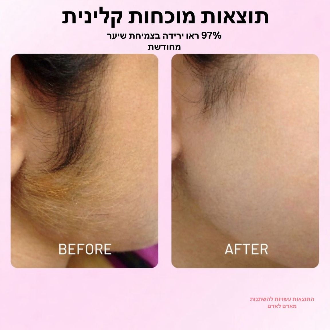 CYPERUS OIL™ - שמן מעכב צמיחה