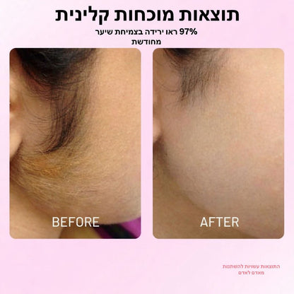 CYPERUS OIL™ - שמן מעכב צמיחה